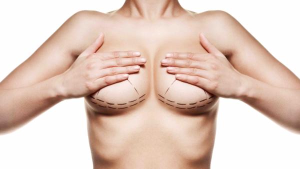 Chirurgia plastica seno