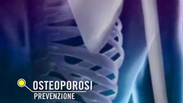 OSTEOPOROSI: LA PREVENZIONE